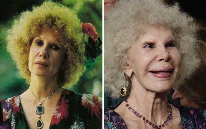 A picture of Cayetana Fitz before and after.